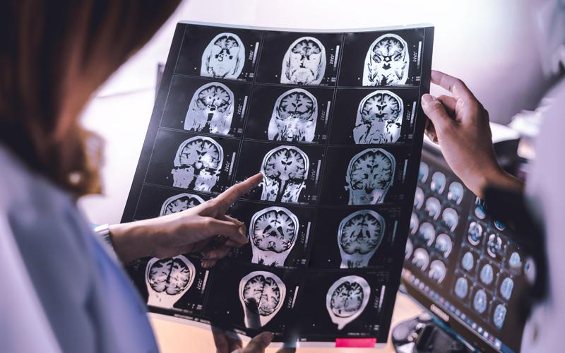 Multimodal Discoveries