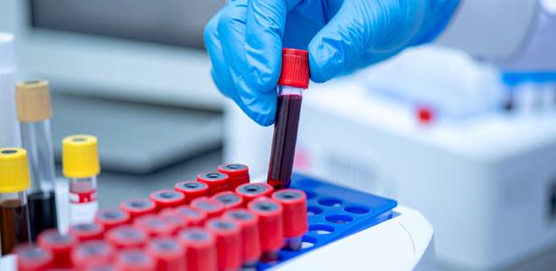 Biomarker Workgroups